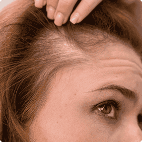 Scalp Aging & Hair Thinning