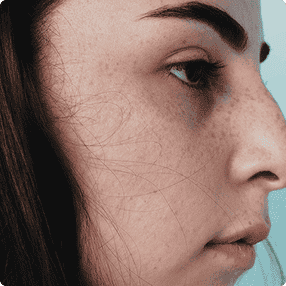 dullness and uneven texture